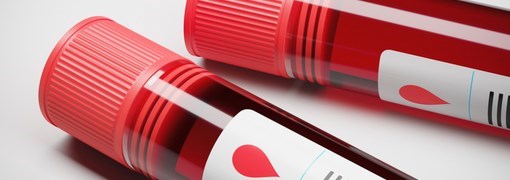 בדיקת Anti-DNA Ab's - תמונה